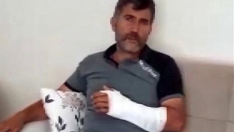 Erzurum’da beslemek istediği ayının saldırısına uğradı