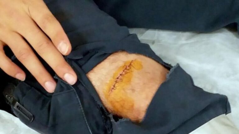İzmir’de alkollü bir kişi, acil serviste sağlık çalışanına makasla saldırdı