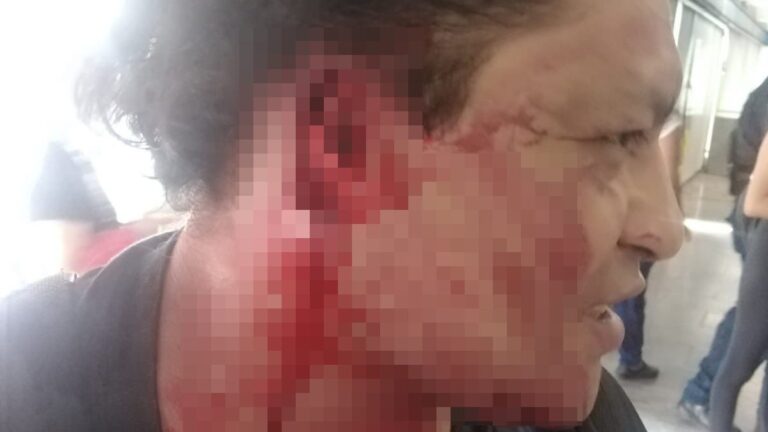 Meksika’da taciz ettiği iddia edilen kişinin kulağını koparttı