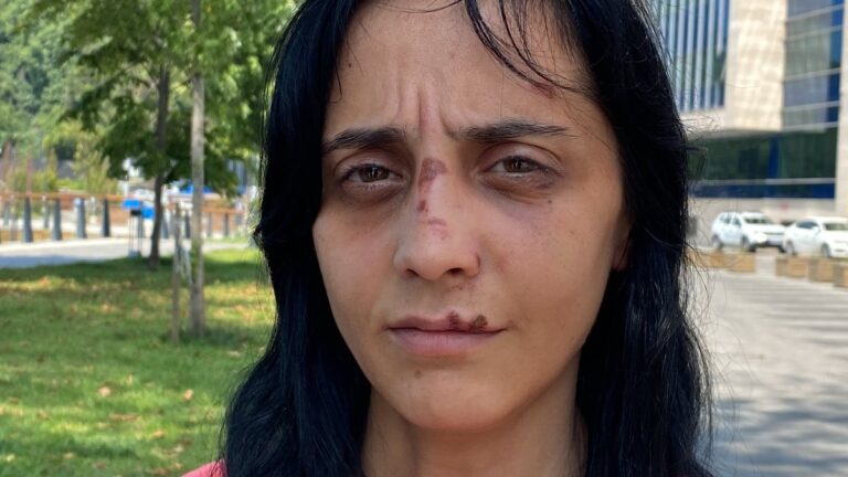 Zonguldak’ta bir kadın, tanımadığı şahsın saldırısına uğradı